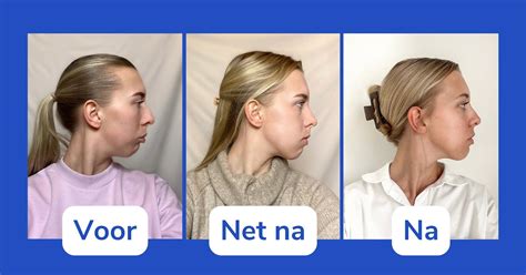 Voor en na foto van een interieur dat is opgeknapt door Christophe Aertssen