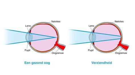 Illustratie die het verschil toont tussen lens shift en keystone correctie.