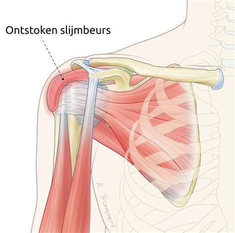 Schema dat de locatie van de slijmbeurs in de schouder illustreert.