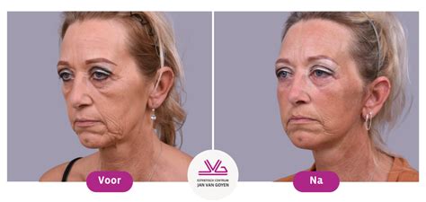 Collage van verschillende woonprogramma's met voor en na foto's van make-overs