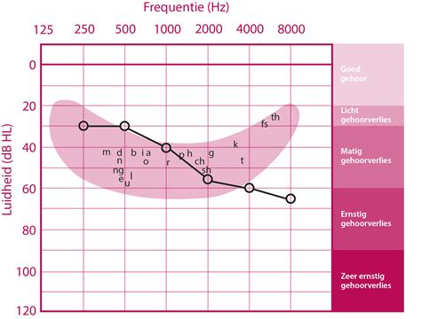 Audiogram van een muziektrack, met visuele indicatie van dynamiekbereik en compressie.
