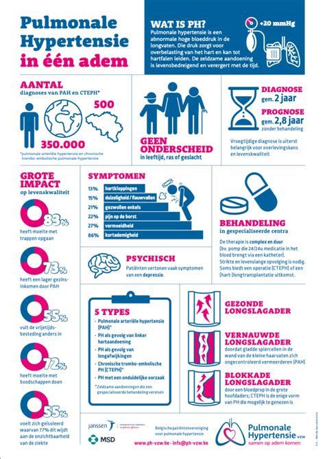Infografiek die de principes van Dolby Atmos uitlegt: geluidsobjecten die vanuit verschillende richtingen komen, inclusief boven het hoofd.